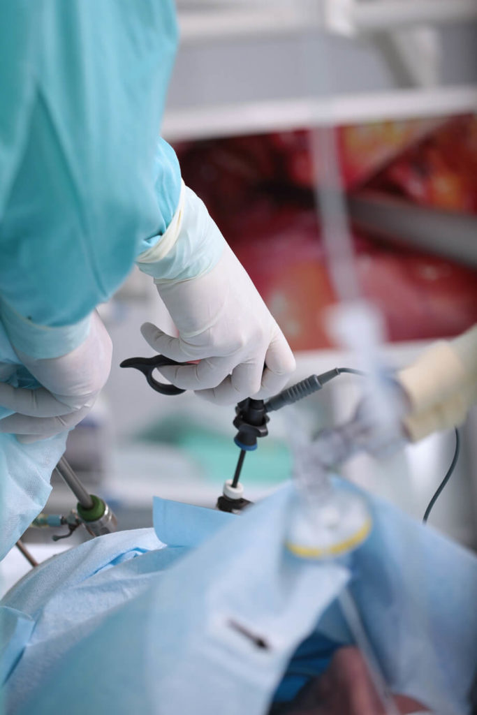 Corpuse Christiy Surgery: Gallbladder operation